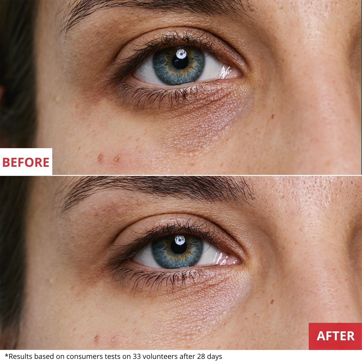 Erborian Skin Therapy Eye - Contorno Occhi Multi-perfezionatore 15 Ml