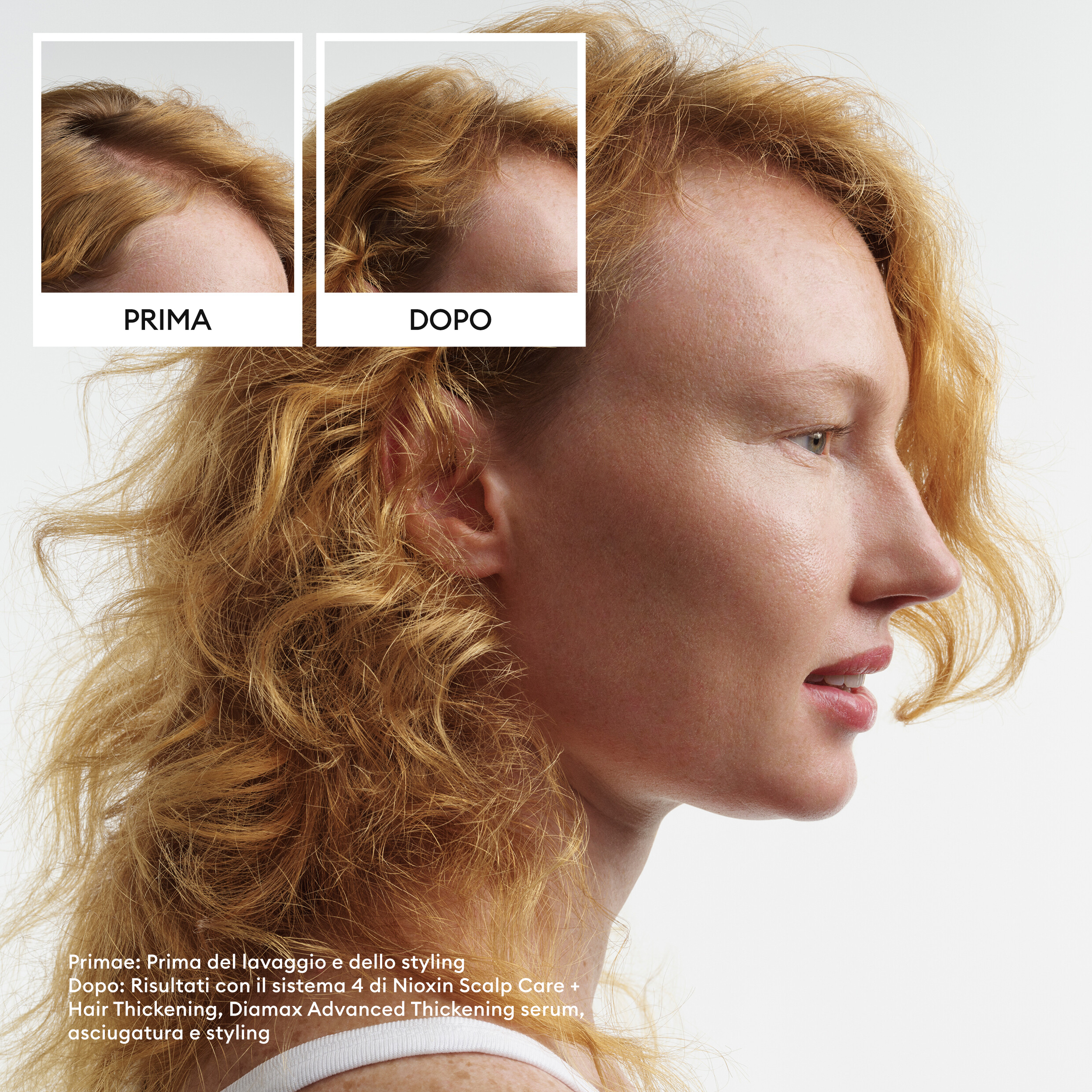 Nioxin System 4 Xl Trattamento Anticaduta Capelli Colorati Molto Diradati