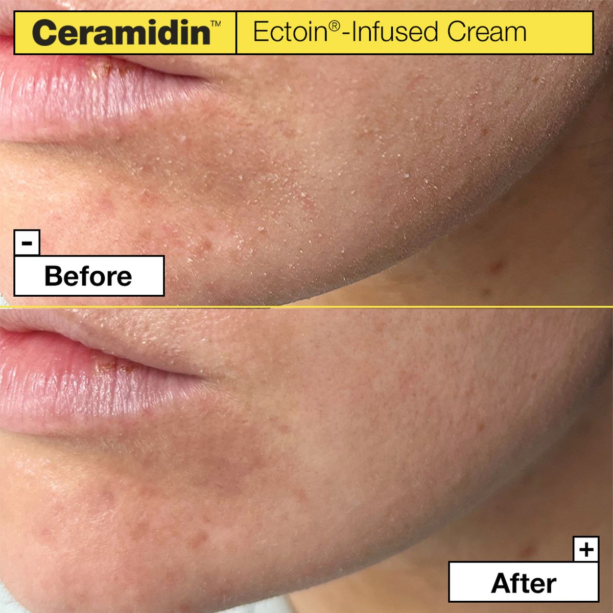 Ceramidin™ Ectoin-infused Cream 50ml