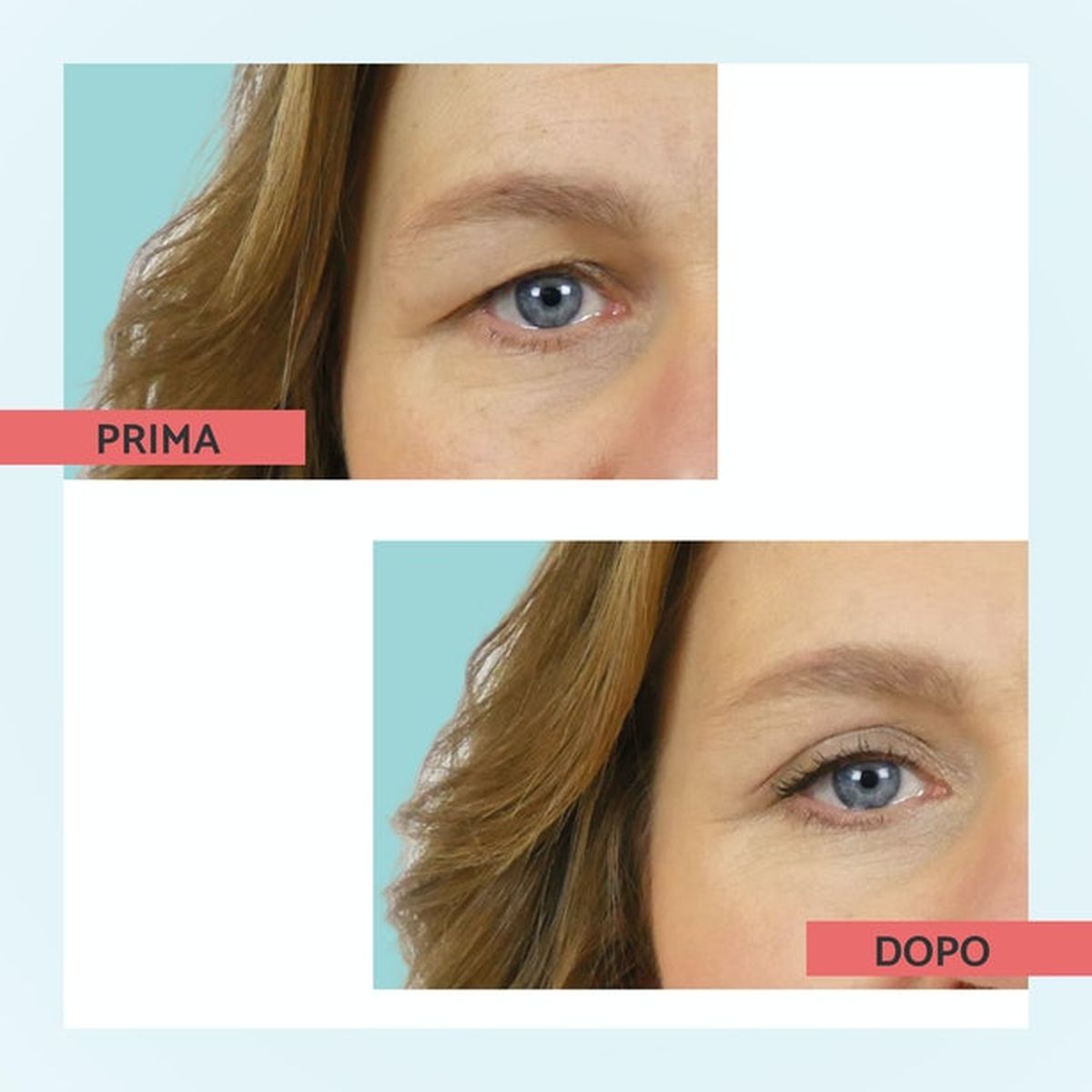 Remescar Palpebre Cadenti 8ml